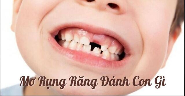 Mơ thấy rụng răng theo bạn đánh con gì dễ trúng?